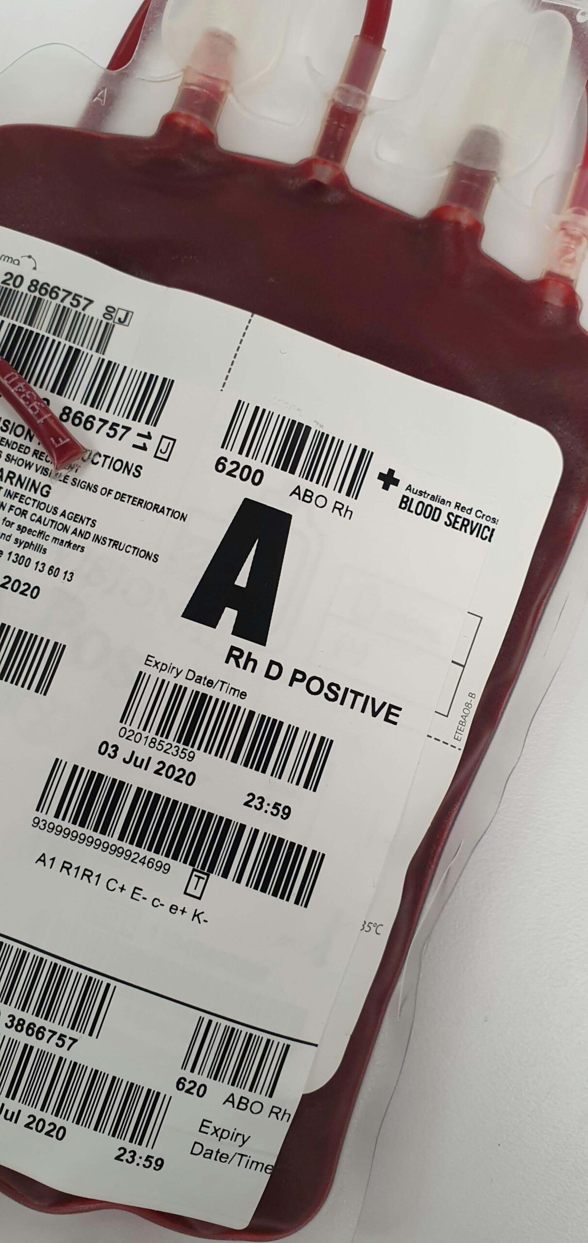 Artificial Intelligence in Hemophilia A